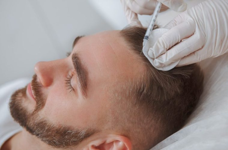 Reasons People Are Opting For Hair Transplants In Turkey - A Trend Analysis